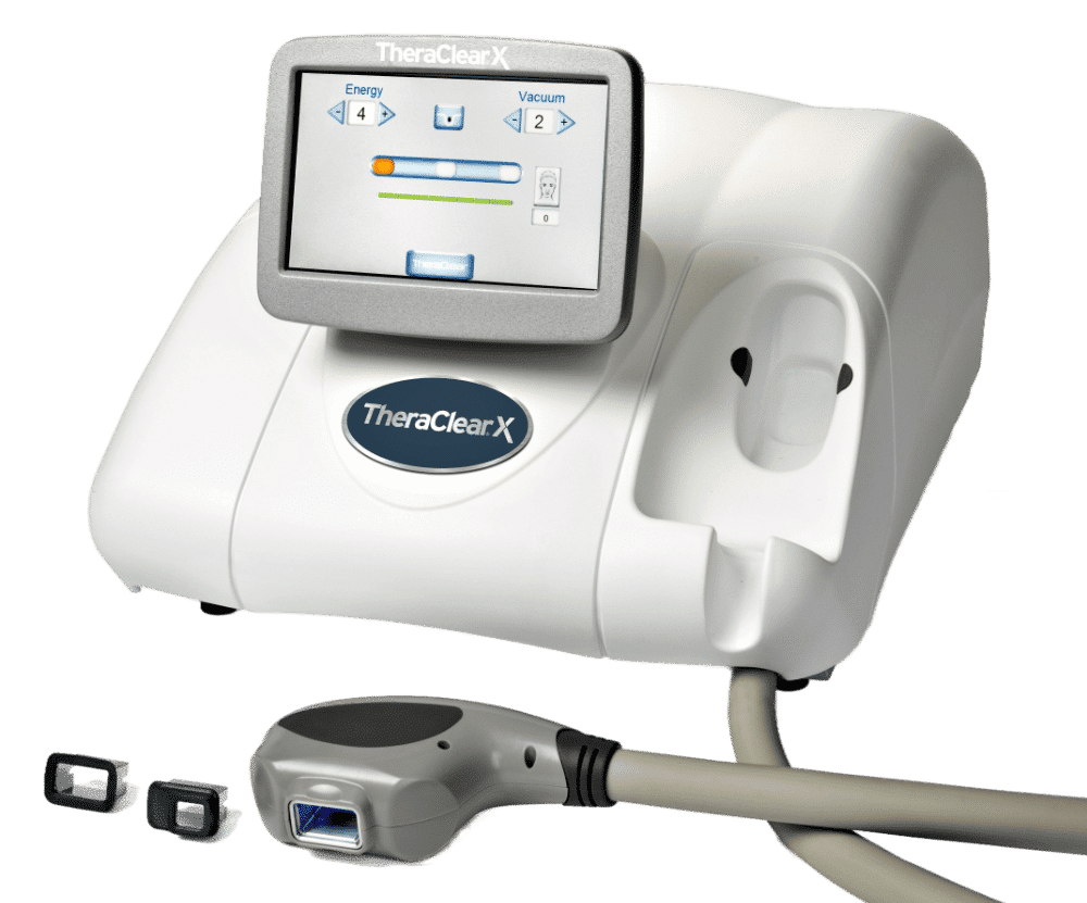 TheraClearX, dispozitiv pentru tratamentul acneei product thumbnail image