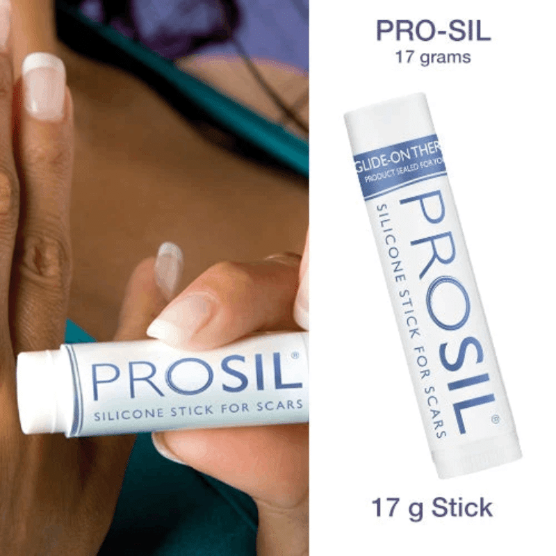 Stick pentru tratamentul cicatricilor, 17g, Pro-Sil product thumbnail image