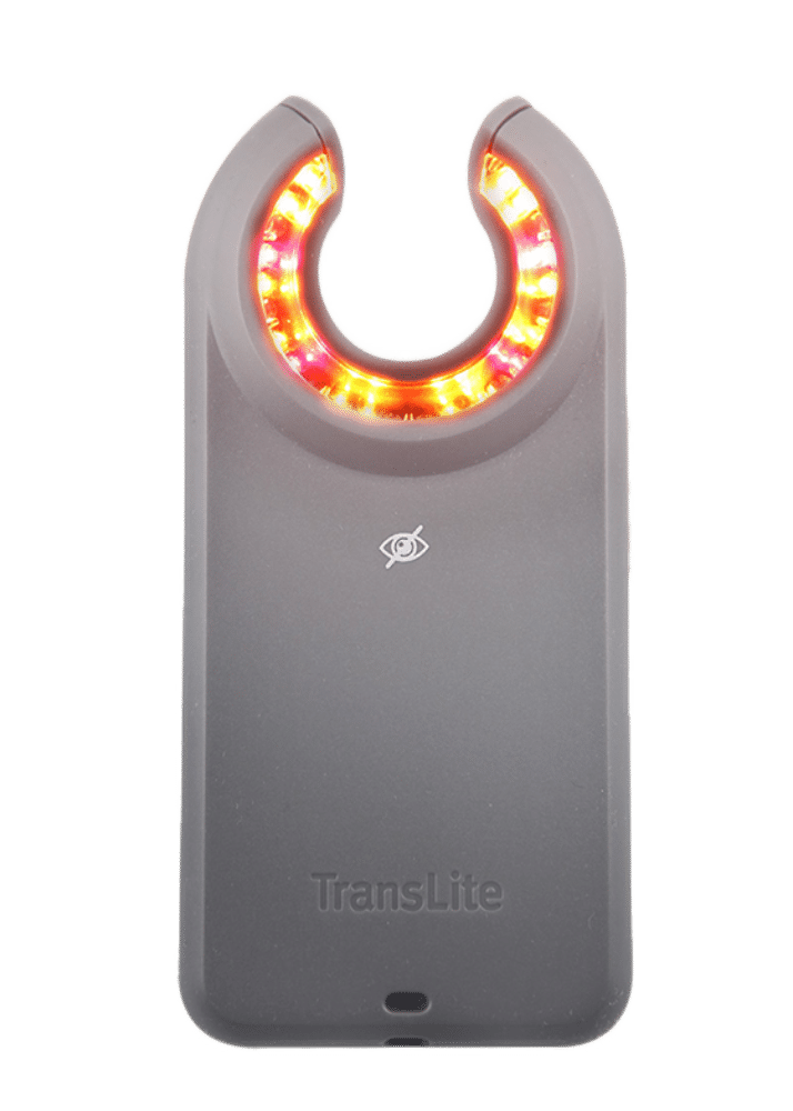 Dispozitiv pentru localizarea venelor - Veinlite EMS PRO product image 2