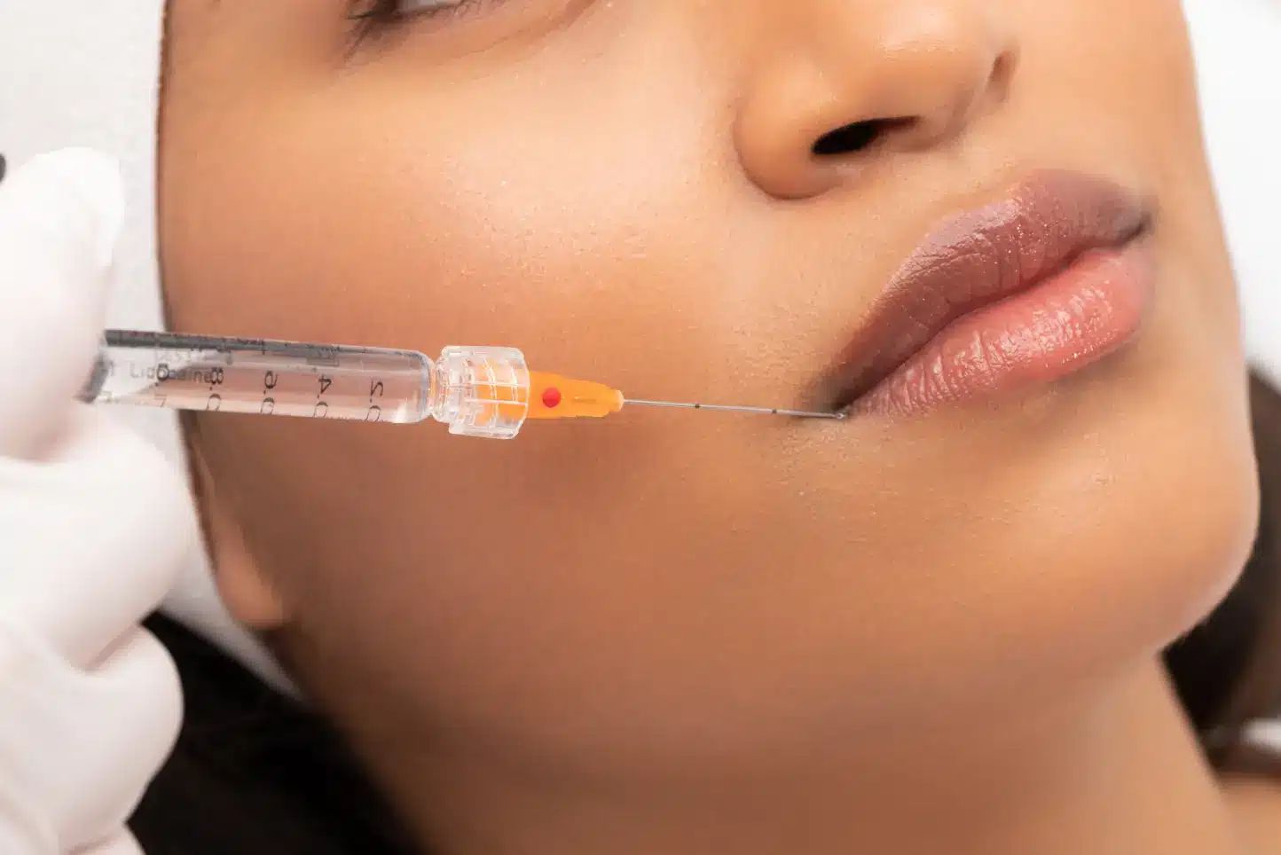 Microcanula 30G 25mm XL, SoftFil Precision product image 7