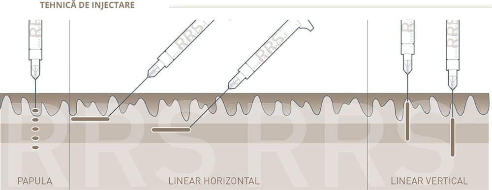 RRS HA Cellutrix - tratament anti celulita product image 2