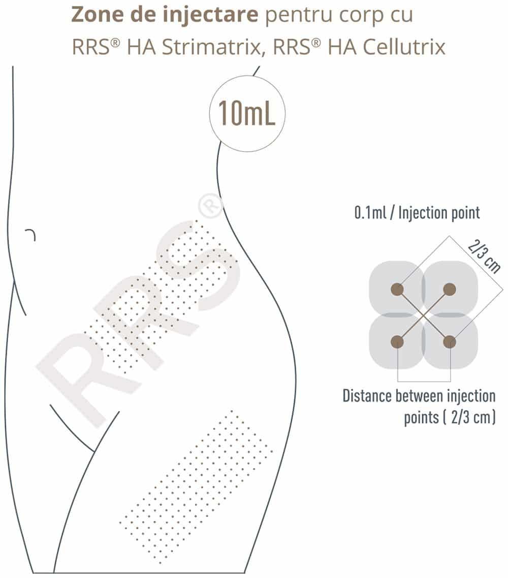 RRS HA Cellutrix - tratament anti celulita product image 3