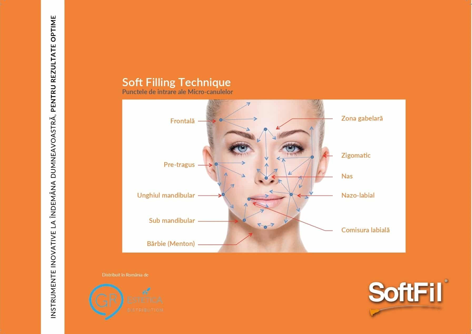 Microcanula 16G 70/90 mm XL, SoftFil Precision product image 3