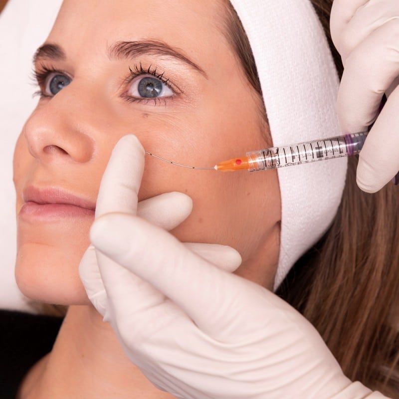 Microcanula 16G 70/90 mm XL, SoftFil Precision product image 8