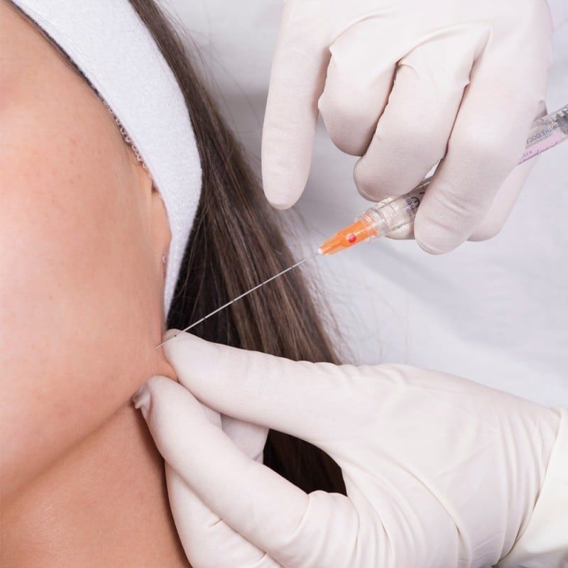 Microcanula 16G 70/90 mm XL, SoftFil Precision product image 9