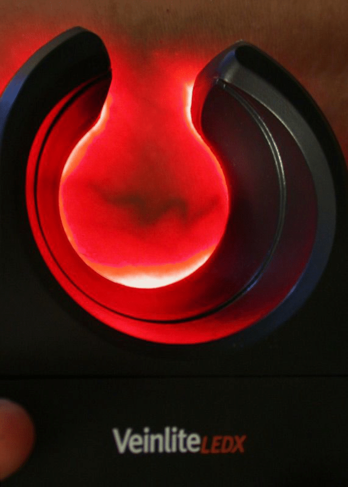 Dispozitiv de căutare a venelor - Veinlite LEDX product image 3