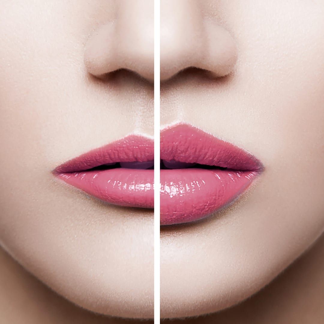 STYLAGE LIPS PLUS Bi-Soft, 1 ml product image 4