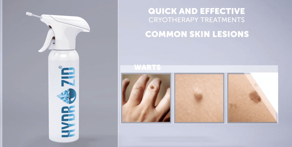 Spray pentru inghetarea negilor, 200ml, Hydrozid product image 4