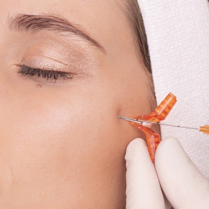 Microcanula 23G 70mm cu ac pre-injectare 5mm, SoftFil EasyGuide product image 5