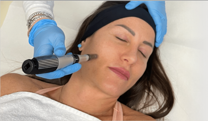 1NEED Pro Campomats, dispozitiv microneedling medical și micropricking estetic product image 4