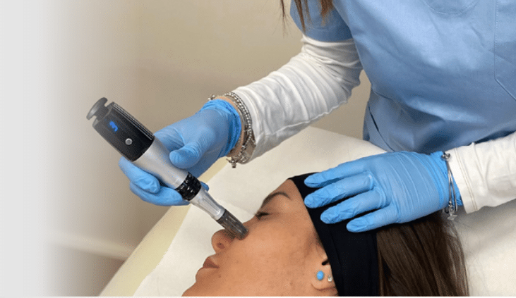 1NEED Pro Campomats, dispozitiv microneedling medical și micropricking estetic product image 5