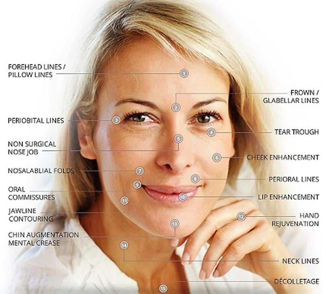 Filler dermic pentru rejuvenarea feței și a gâtului, Harmonyca Juvederm, 1 seringă x 1.25 ml product image 2