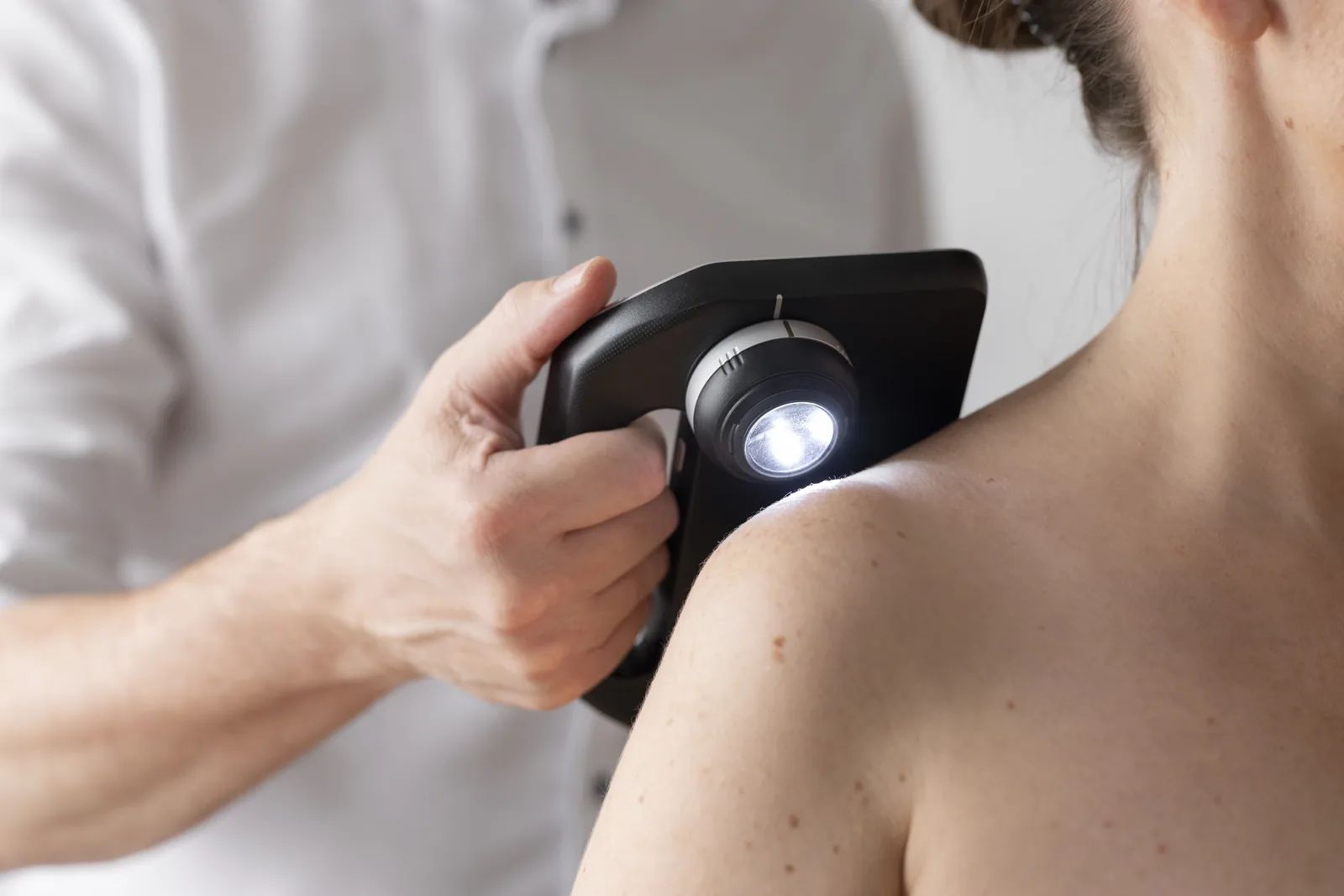 DermLite Skeen – dermatoscop cu analiză AI pentru piele și păr product image 3