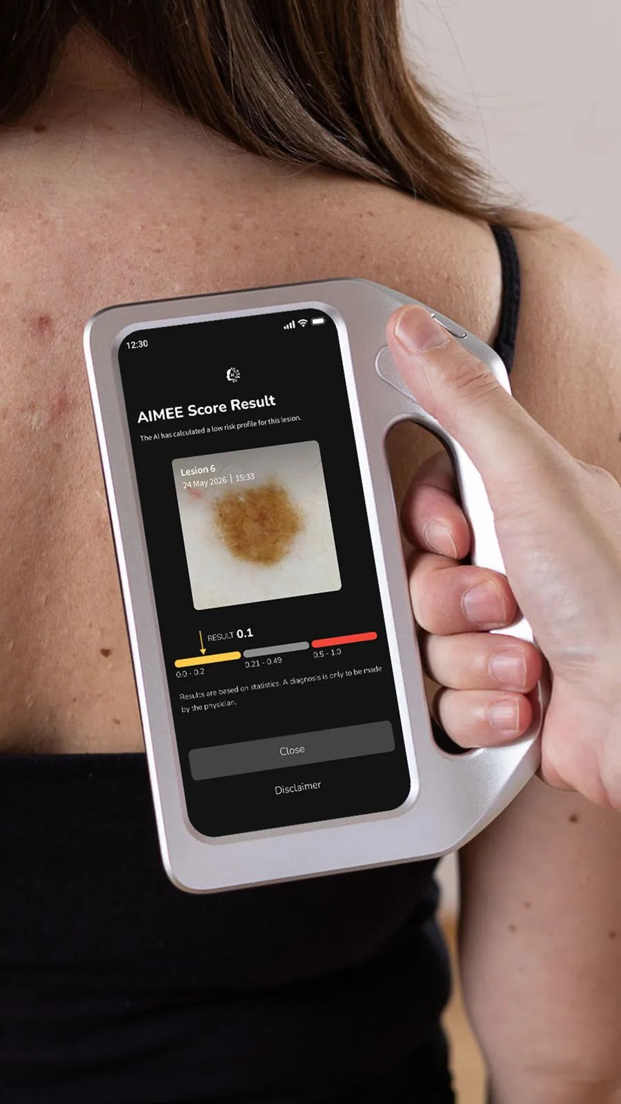 DermLite Skeen – dermatoscop cu analiză AI pentru piele și păr product image 4
