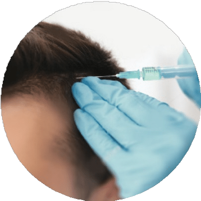medigraft, tricologie
